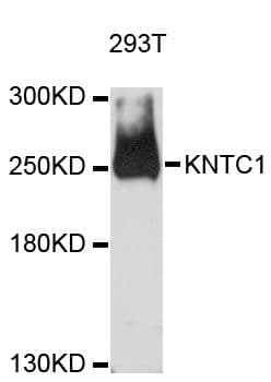 KNTC1 / ROD Antibody