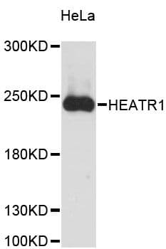 Polyclonal Rabbit anti-Human HEATR1 Antibody (WB)
