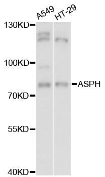 Polyclonal Rabbit anti-Human Junctin / ASPH Antibody (WB)