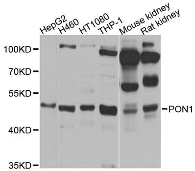 Polyclonal Rabbit anti-Human PON1 / ESA Antibody (WB)