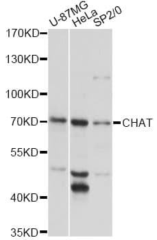 Polyclonal Rabbit anti-Human CHAT Antibody (IF, WB)