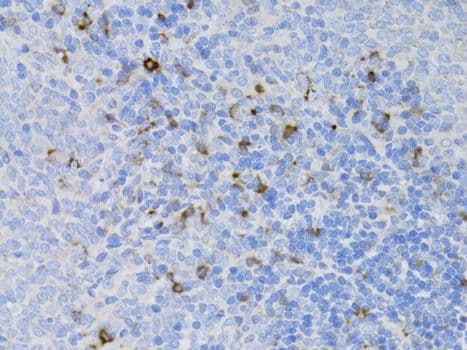 Polyclonal Rabbit anti-Human CD68 Antibody (IHC, WB)