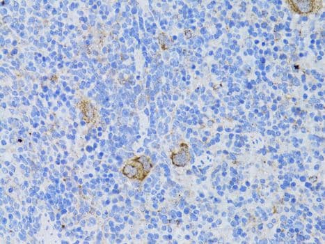 Polyclonal Rabbit anti-Human CD68 Antibody (IHC, WB)