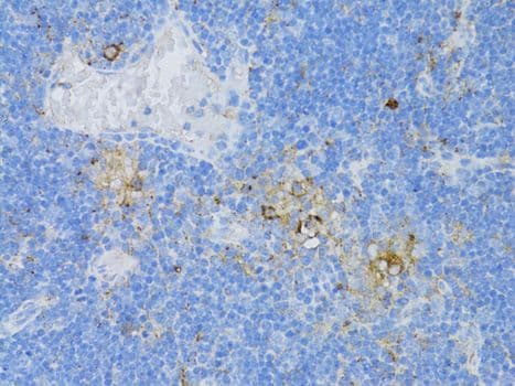 Polyclonal Rabbit anti-Human CD68 Antibody (IHC, WB)