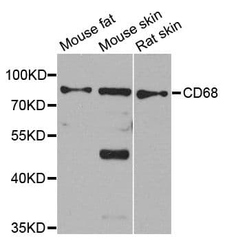 Polyclonal Rabbit anti-Human CD68 Antibody (IHC, WB)