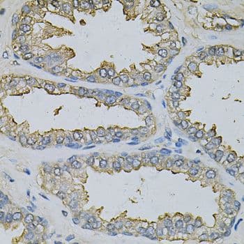 Polyclonal Rabbit anti-Human DBI / ACBD1 Antibody (IHC, IF, WB)