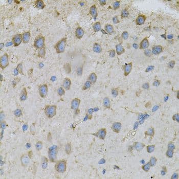 Polyclonal Rabbit anti-Human DBI / ACBD1 Antibody (IHC, IF, WB)