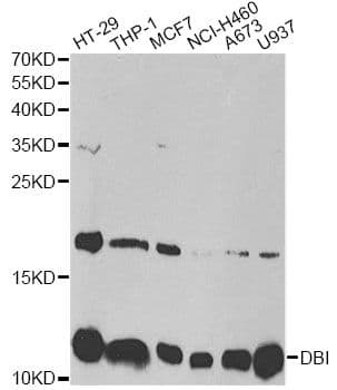 Polyclonal Rabbit anti-Human DBI / ACBD1 Antibody (IHC, IF, WB)