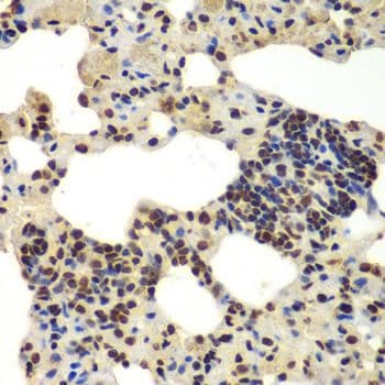 Polyclonal Rabbit anti-Human DDX5 Antibody (IHC, IF, WB)