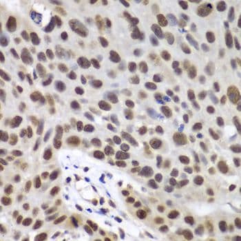 Polyclonal Rabbit anti-Human DDX5 Antibody (IHC, IF, WB)