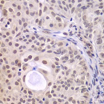 Polyclonal Rabbit anti-Human DDX5 Antibody (IHC, IF, WB)