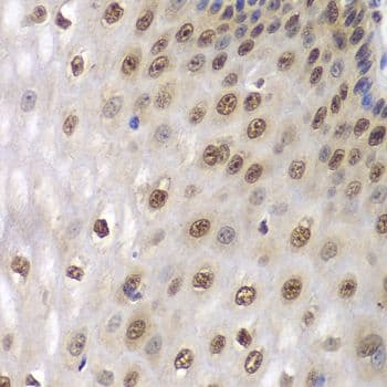 Polyclonal Rabbit anti-Human DDX5 Antibody (IHC, IF, WB)