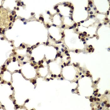 Polyclonal Rabbit anti-Human DDX5 Antibody (IHC, IF, WB)