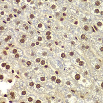 Polyclonal Rabbit anti-Human DDX5 Antibody (IHC, IF, WB)
