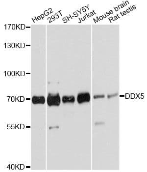 Polyclonal Rabbit anti-Human DDX5 Antibody (IHC, IF, WB)