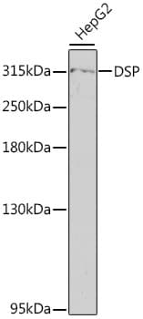 Polyclonal Rabbit anti-Human DSP / Desmoplakin Antibody (IHC, WB)