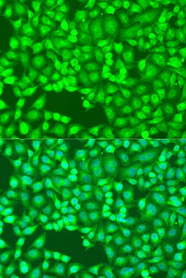 Polyclonal Rabbit anti-Human FLT4 / VEGFR3 Antibody (IF, WB)