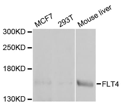 Polyclonal Rabbit anti-Human FLT4 / VEGFR3 Antibody (IF, WB)