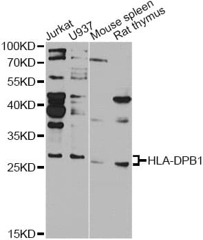 Polyclonal Rabbit anti-Human HLA-DPB1 Antibody (IHC, WB)