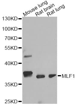 Polyclonal Rabbit anti-Human MLF1 Antibody (IF, WB)