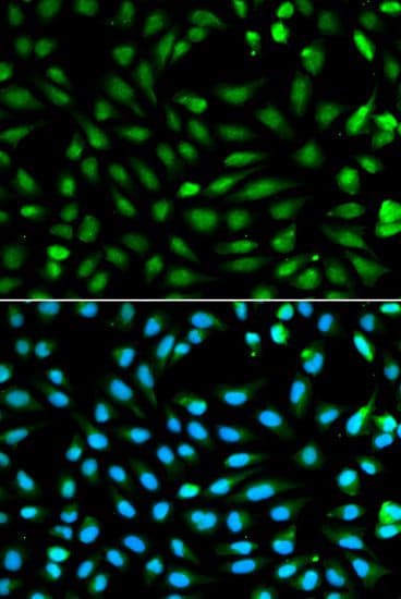 Polyclonal Rabbit anti-Human PCNA Antibody (IF, WB)