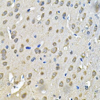Polyclonal Rabbit anti-Human PRKAB2 / AMPK Beta 2 Antibody (IHC, IF, WB)