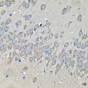 Polyclonal Rabbit anti-Human PRKAB2 / AMPK Beta 2 Antibody (IHC, IF, WB)