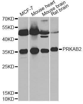 Polyclonal Rabbit anti-Human PRKAB2 / AMPK Beta 2 Antibody (IHC, IF, WB)