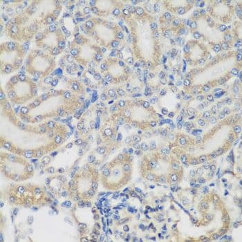 Polyclonal Rabbit anti-Human PYCR1 Antibody (IHC, WB)