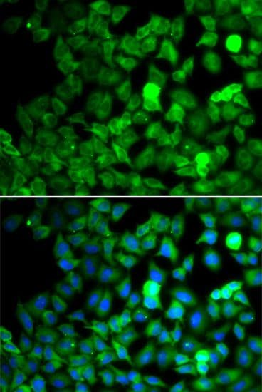 Polyclonal Rabbit anti-Human SARS / Serine-tRNA Ligase Antibody (IHC, IF, WB)