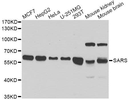 Polyclonal Rabbit anti-Human SARS / Serine-tRNA Ligase Antibody (IHC, IF, WB)