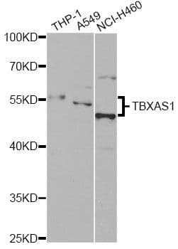 Polyclonal Rabbit anti-Human TS / Thromboxane Synthase Antibody (IHC, IF, WB)