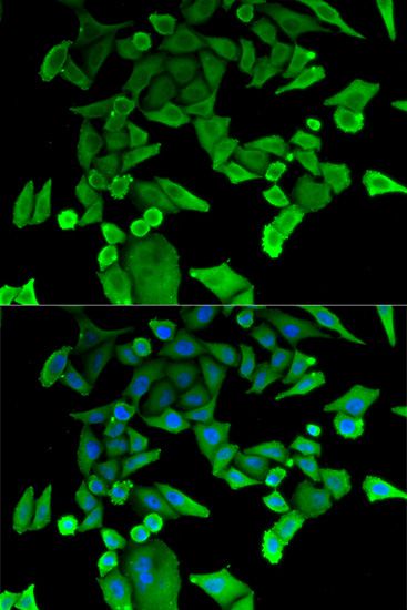TPT1 / TCTP Antibody