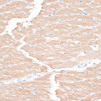 EGFR Antibody