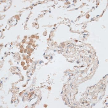 EGFR Antibody
