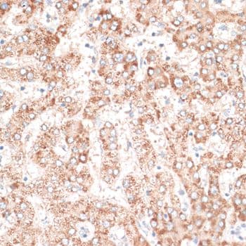 EGFR Antibody