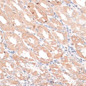 EGFR Antibody