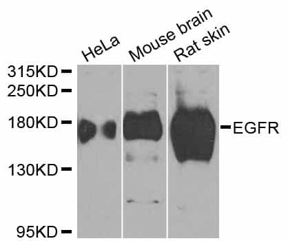 EGFR Antibody