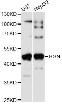 Polyclonal Rabbit anti-Human BGN / Biglycan Antibody (WB)