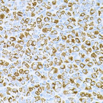 Polyclonal Rabbit anti-Human DLK1 / Pref-1 Antibody (IHC, WB)