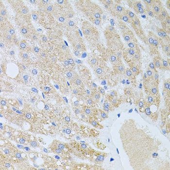 Polyclonal Rabbit anti-Human DLK1 / Pref-1 Antibody (IHC, WB)