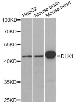 Polyclonal Rabbit anti-Human DLK1 / Pref-1 Antibody (IHC, WB)
