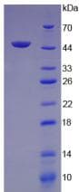 Human VEGFC Protein (Recombinant His, N-Terminal)