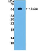 Human VEGFC Protein (Recombinant His, N-Terminal)