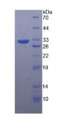 Human TUBB / Beta Tubulin Protein (Recombinant His, N-Terminal)