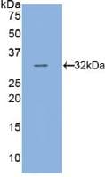 Human TUBB / Beta Tubulin Protein (Recombinant His, N-Terminal)