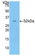 Human CTSV / Cathepsin V Protein (Recombinant His, N-Terminal)