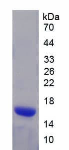 Human PLP1 / Myelin PLP Protein (Recombinant GST-His, N-terminus)