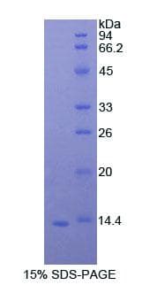 STAT3 Protein (Recombinant His, N-Terminal)