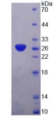 Human SNAP25 Protein (Recombinant His, N-Terminal)